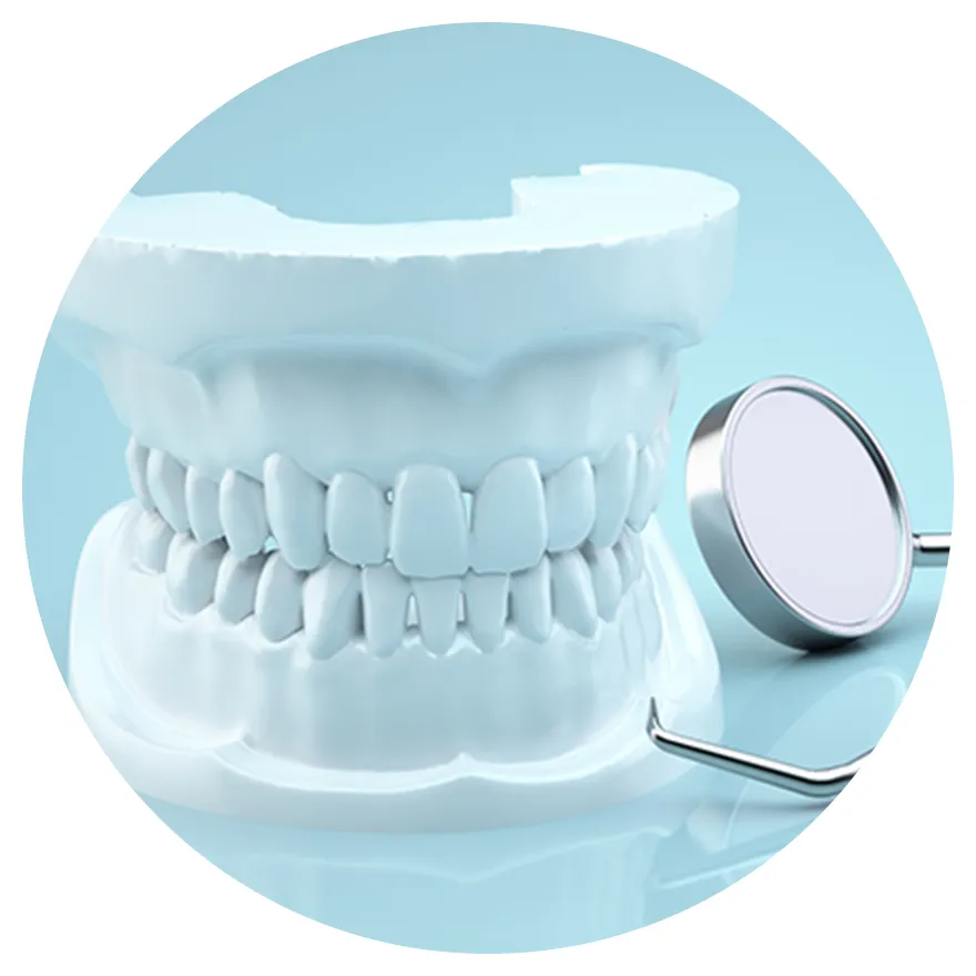 コンポジットレジン修復